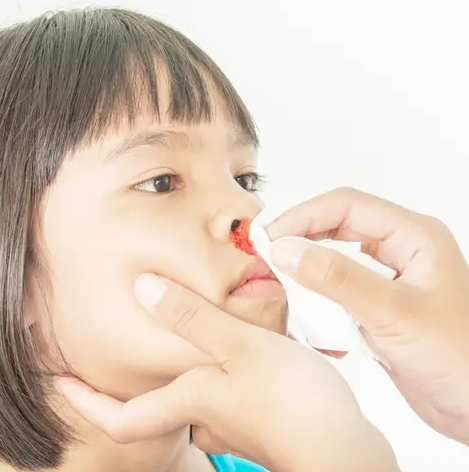 코피나는이유 계속 많이 자주 아이 어른 원인 지혈 관리 방법