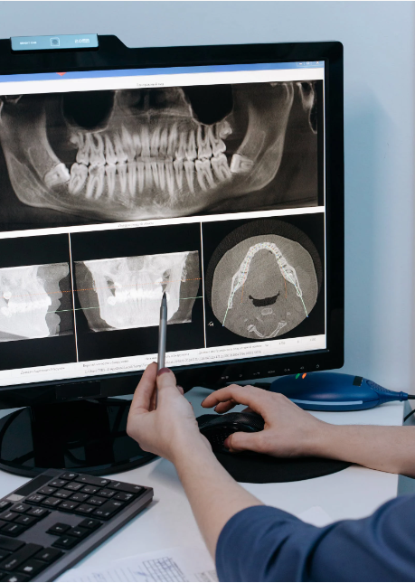 치과 신경치료와 크라운치료