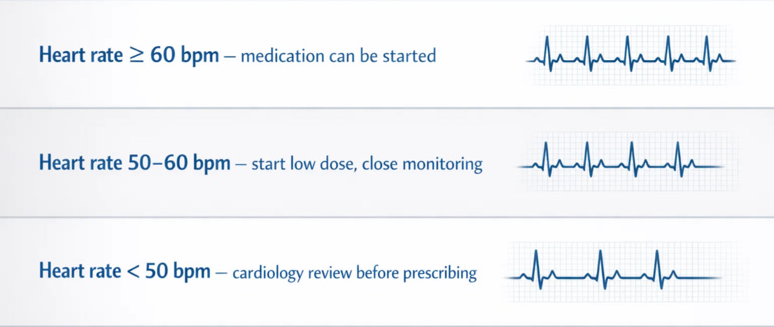 심박수 60회 이상과 50~60회 50회 미만에 따른 치매 약 처방 판단 기준 도식