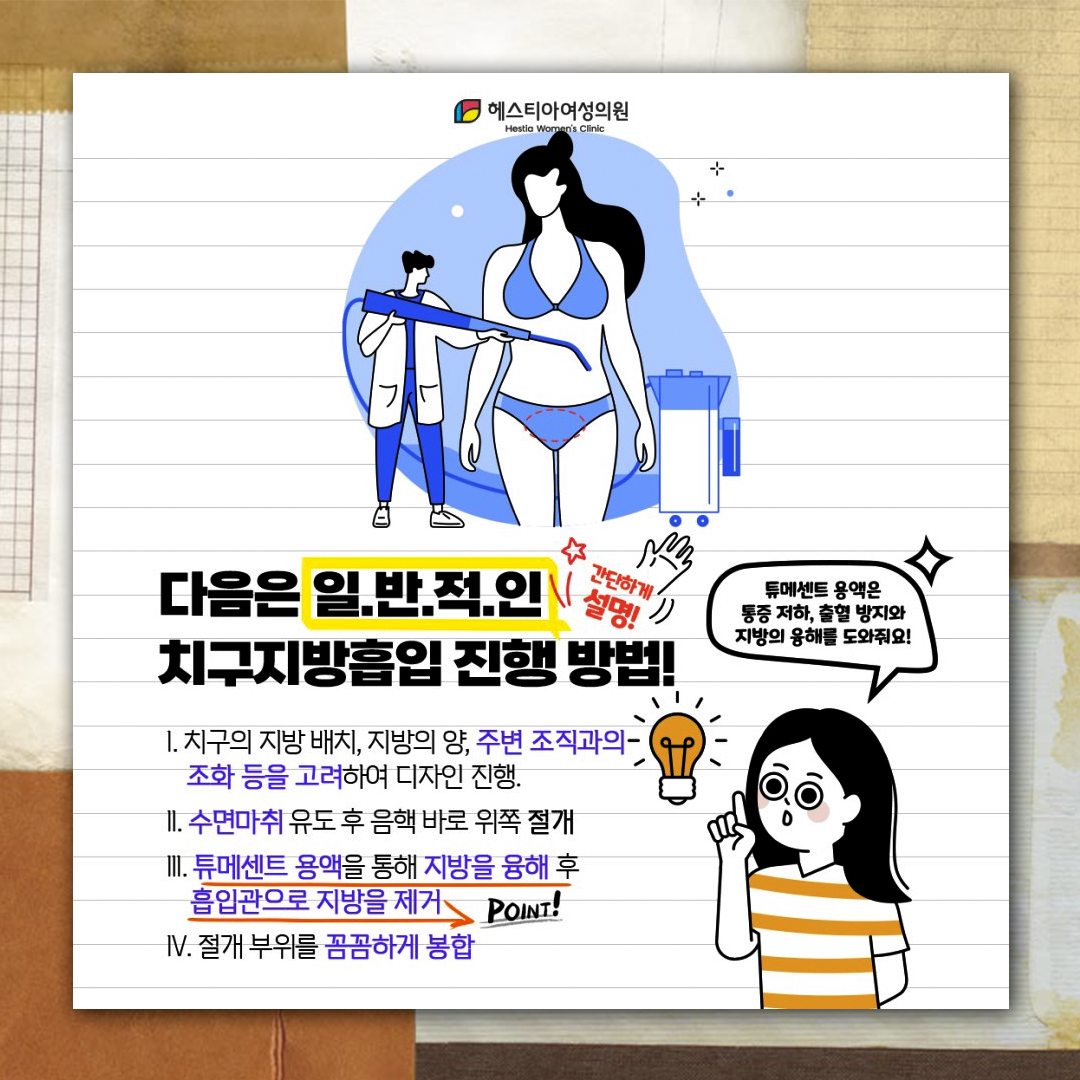 치구지방흡입 진행 방법