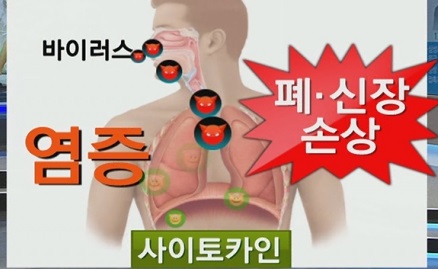사이토카인폭풍06