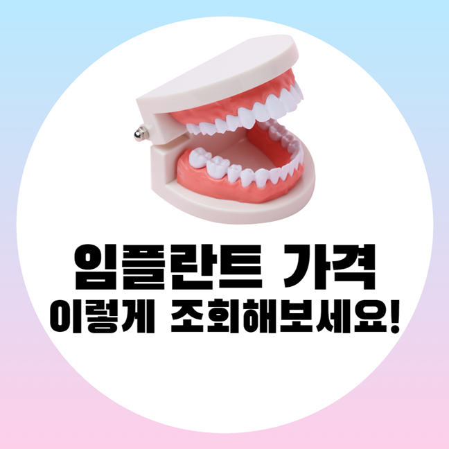 임플란트 가격