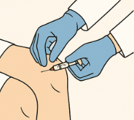 프롤로 주사 프롤로 치료란 프롤로 주사 가격 (병원별 가격 리스트)과 효과 총정리