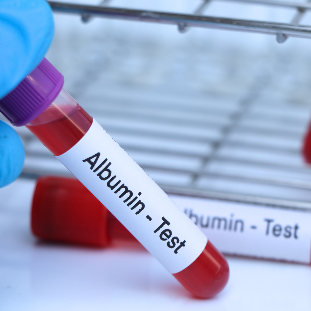 알부민의 효능 테스트