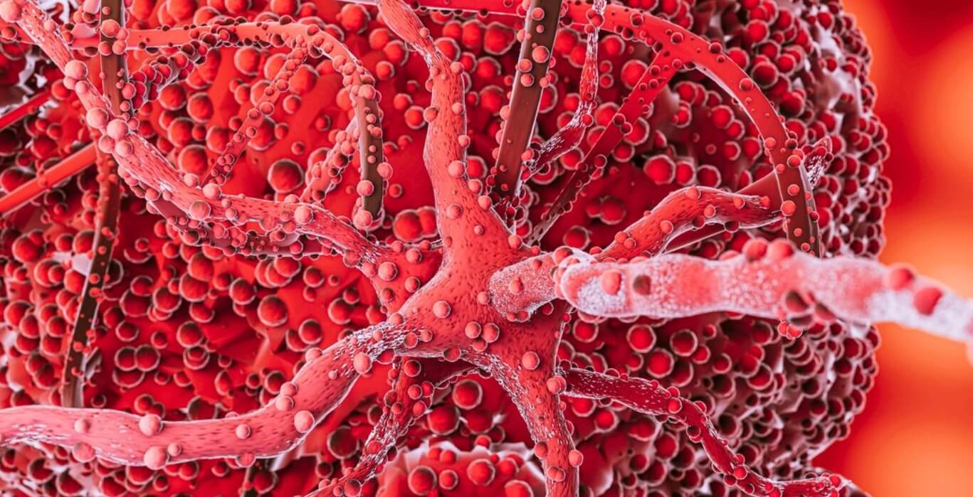 혈액 속 지질 이미지