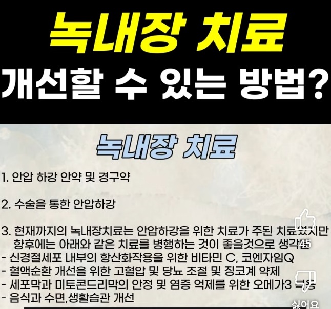 EBS-명의-녹내장-명의-박찬기-교수