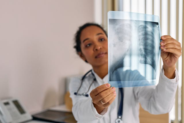 A picture of pneumonia