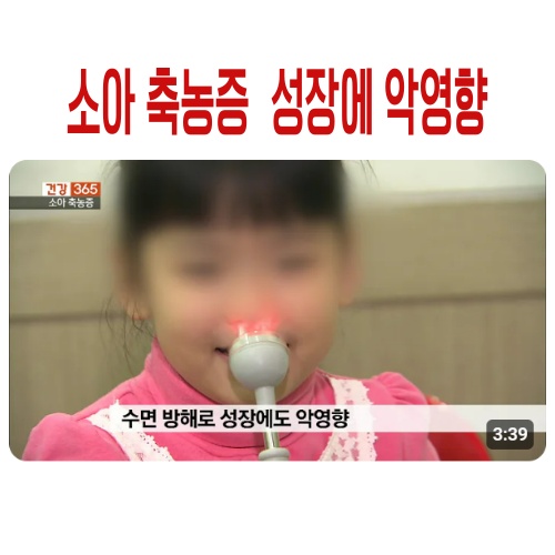 소아축농증의 악영향