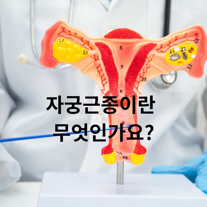 자궁근종 증상과 자궁근종에 좋은 영양제