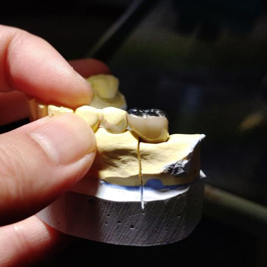 임플란트 성공률과 유지 관리의 중요성1