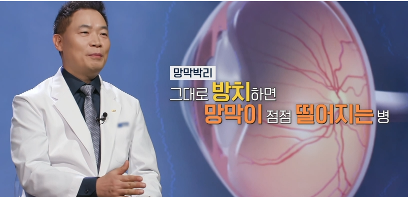 안과명의 이성진교수 썸네일