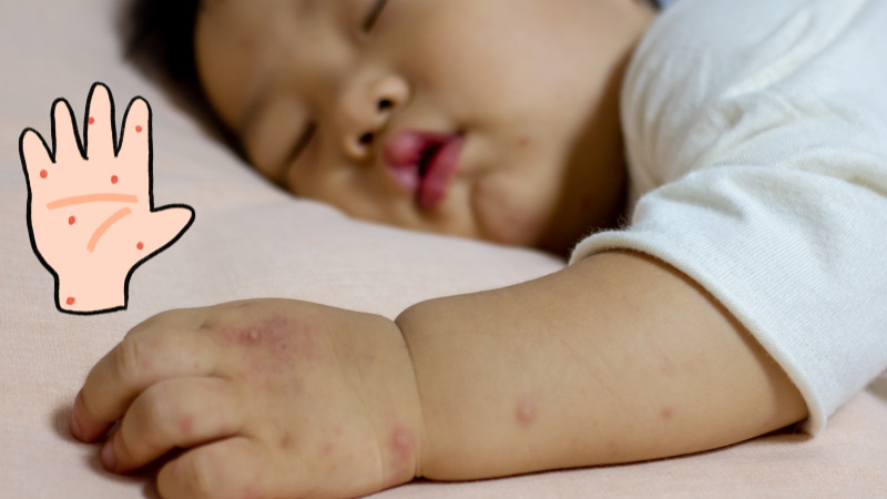 손씻기와 위생관리로 수족구병 예방하는 모습