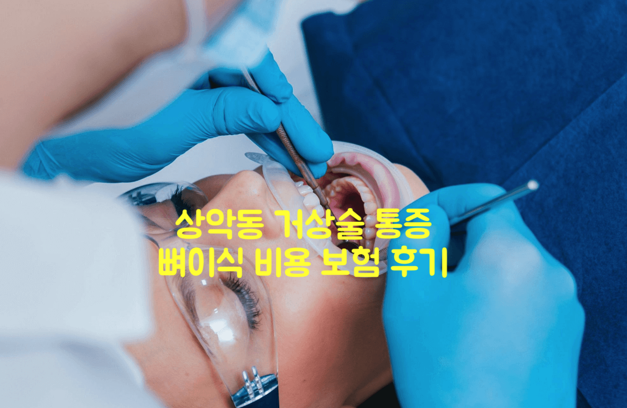 상악동거상술