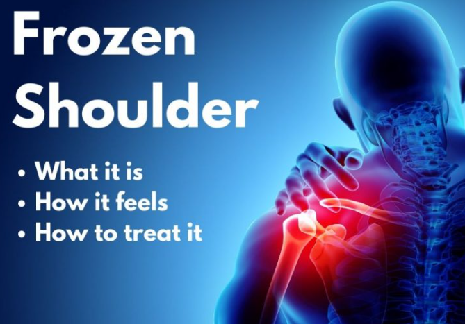 Frozen Shoulder