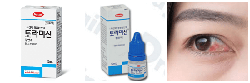 토라미신점안액, 결막염 사진