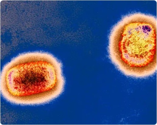 엠폭스 증상 및 원인