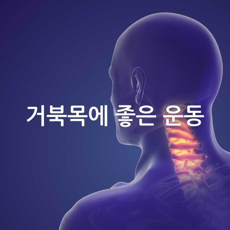 거북목 증후군