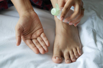 무좀 티트리 오일