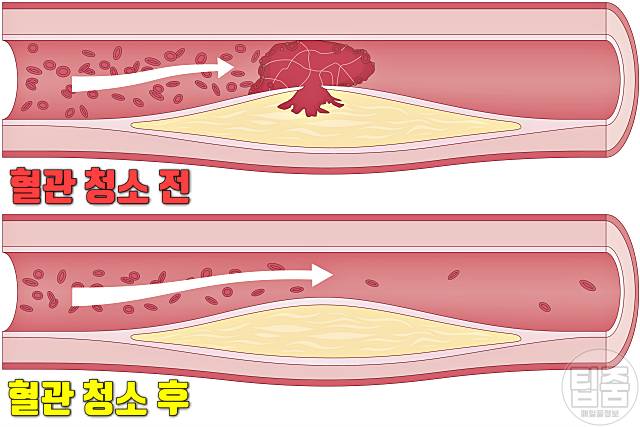 다슬기 효능 부작용 콜레스테롤 혈관청소