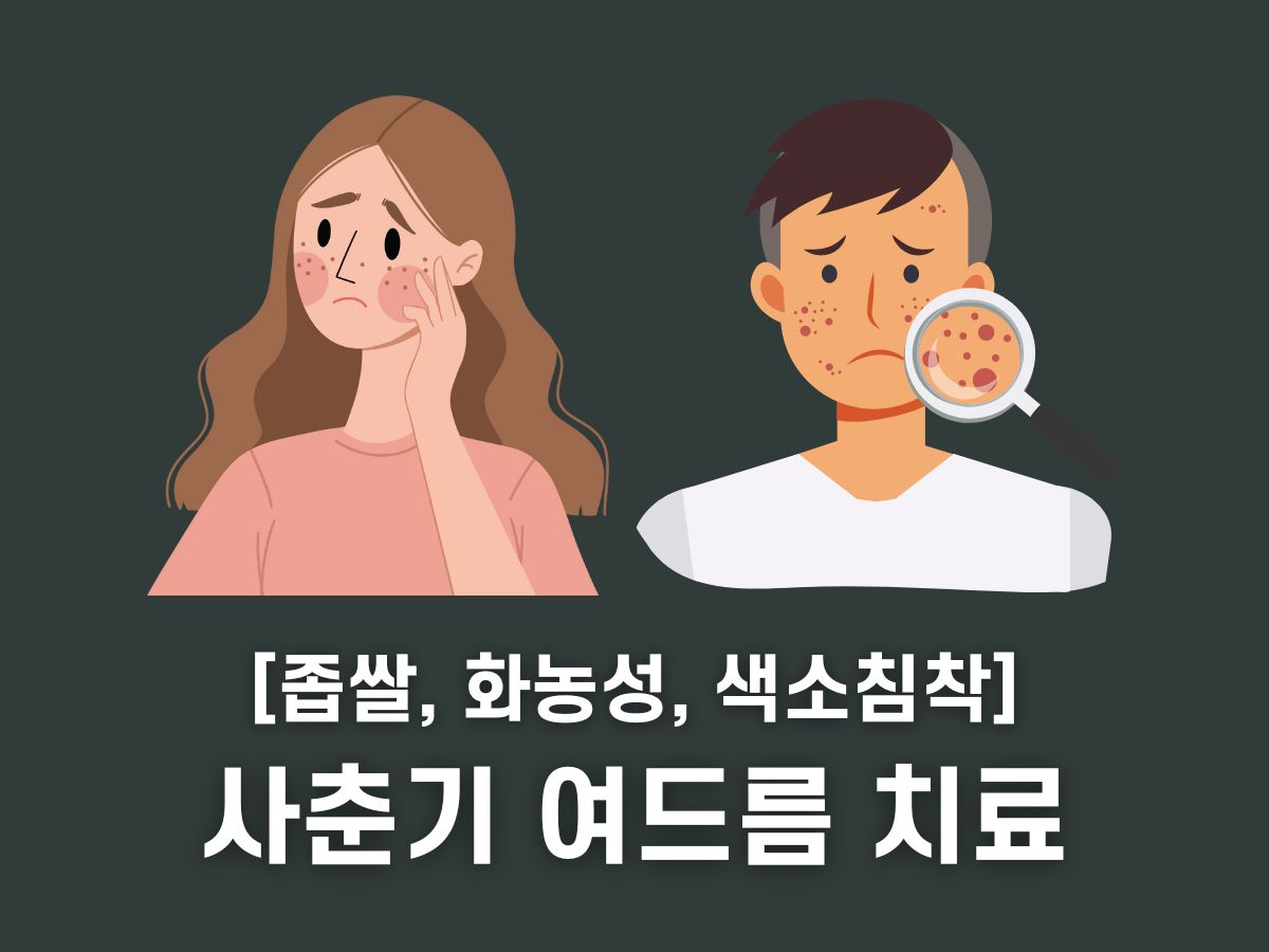 사춘기 여드름 치료 연고