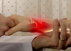 손목 터널 증후군