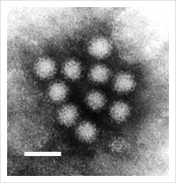 노로바이러스 장염 증상, 원인, 잠복기, 전염 특성, 치료 예방법