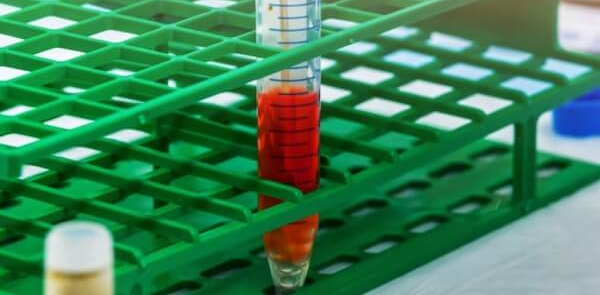 혈액이-담겨있는-샘플