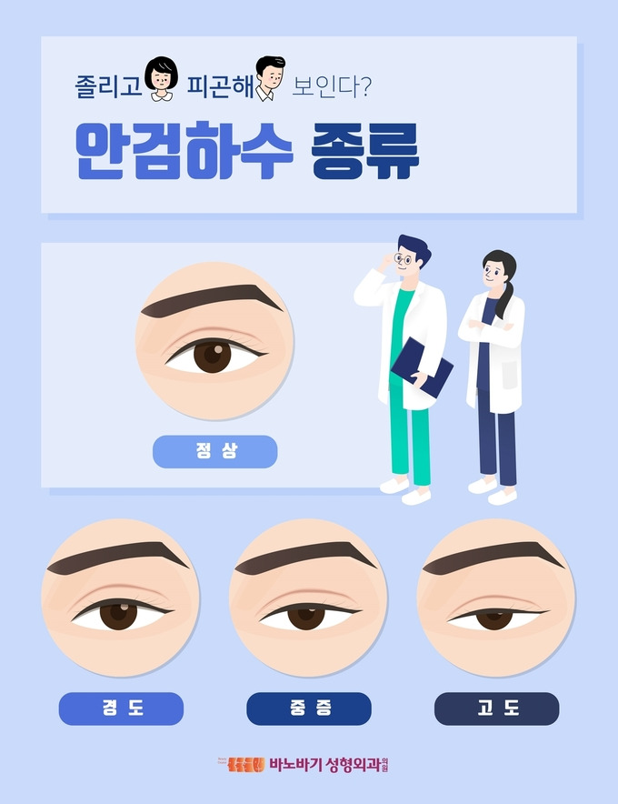 안검하수 관련 이미지
