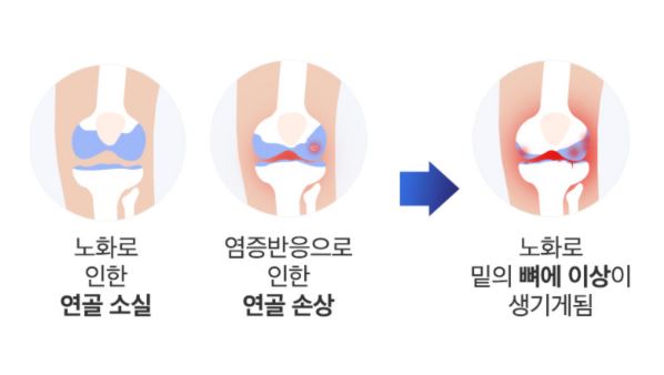 콘드로이친1200mg