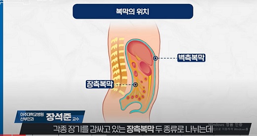 복막의위치