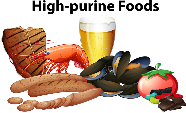 통풍을 유발하는 음식들