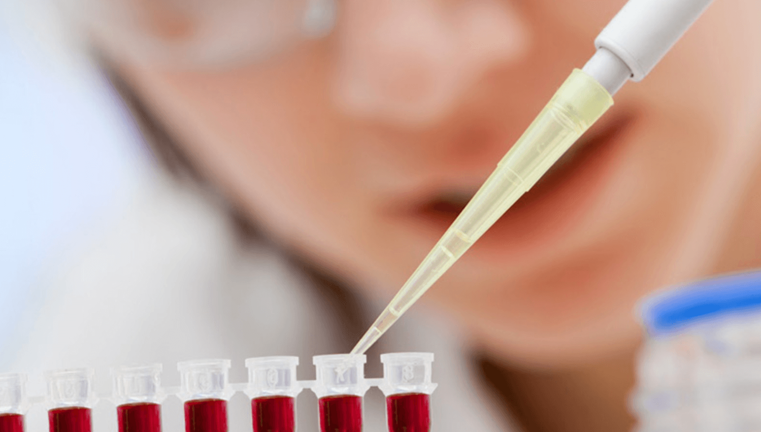 클라인펠터 증후군치료