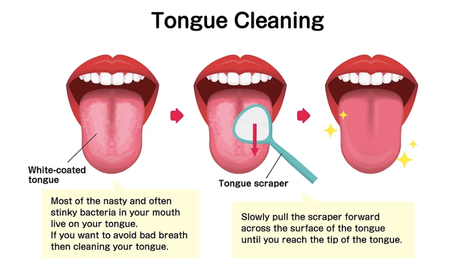 입냄새 제거 해결방법