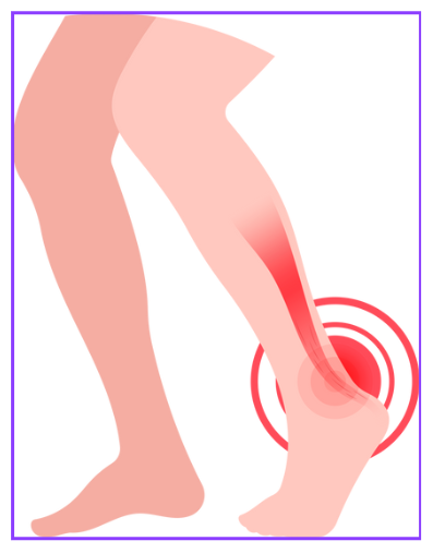 족저근막염 증상 자가 치료법 깔창 선택 방법