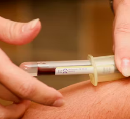 유방 섬유선종 맘모통 제거 수술비용