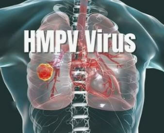 HMPV 중국 메타뉴모바이러스