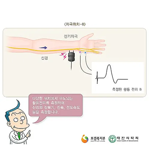 신경전도 검사 결과