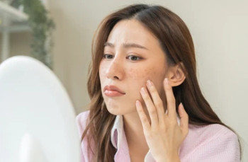 트라넥삼산