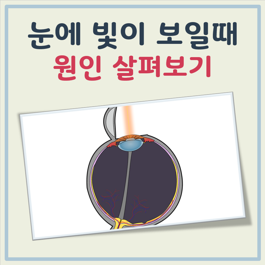 눈에 빛이 보일 때 대표 이미지