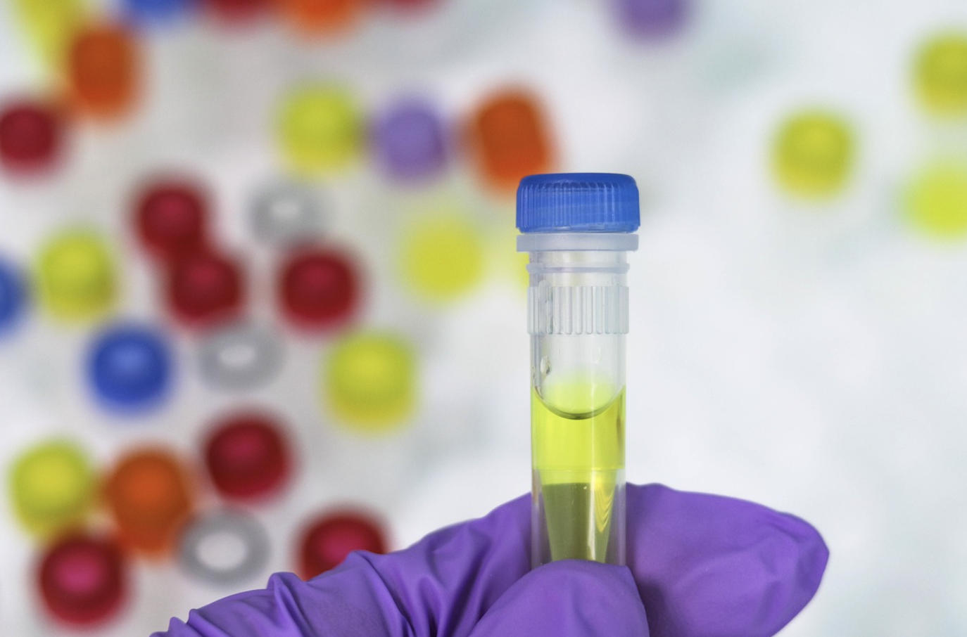 유전자 분석을 통한 맞춤 건강 관리! 내 몸에 최적화된 건강 루틴 찾기