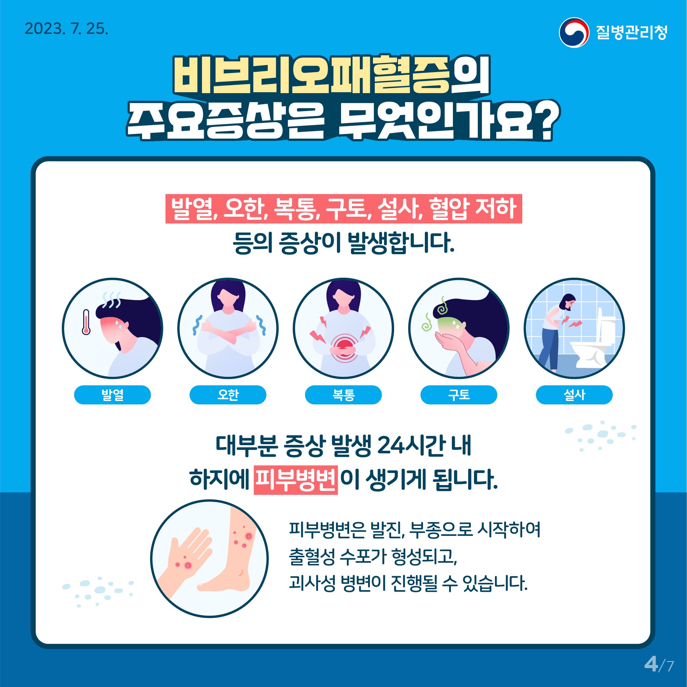 비브리오 패혈증