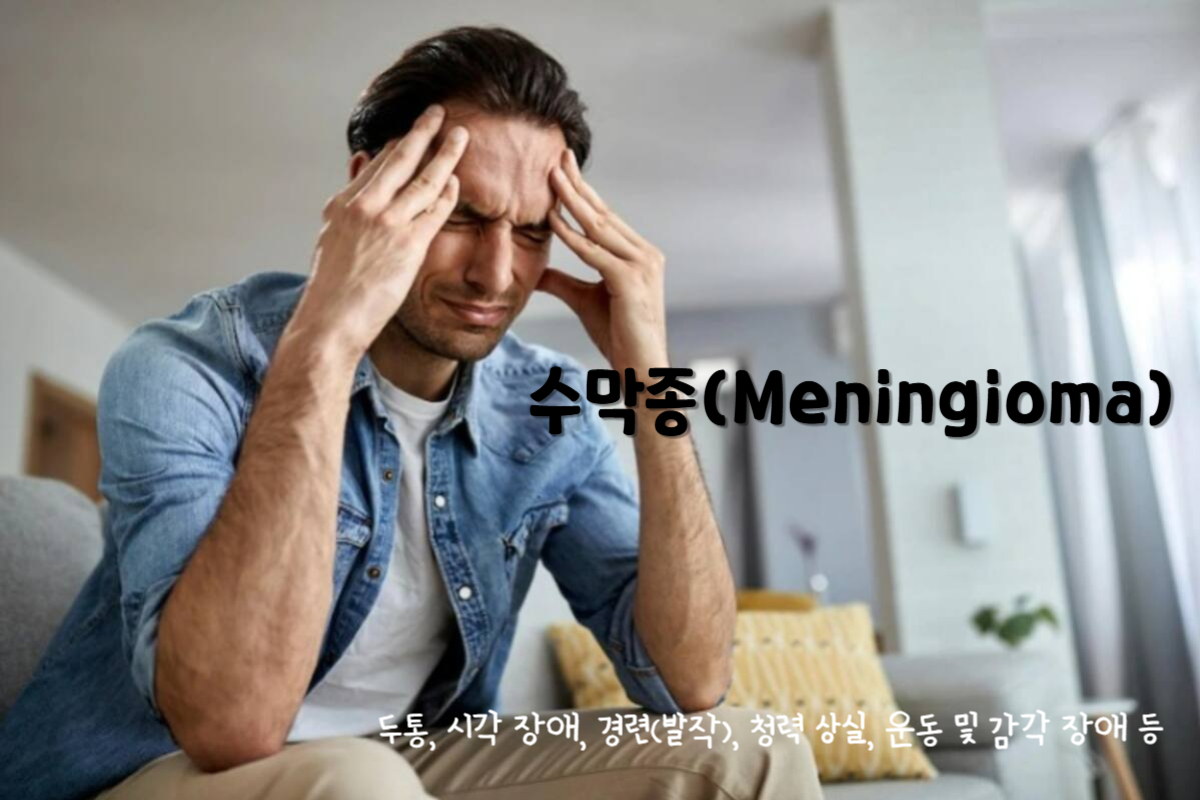 수막종(Meningioma)
수막종 주요 증상 : 두통, 시각 장애, 경련(발작), 청력 상실, 운동 및 감각 장애 등