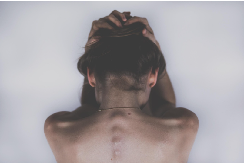 기저세포암 완전정복