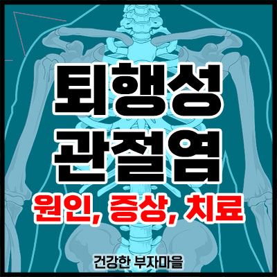 퇴행성 관절염