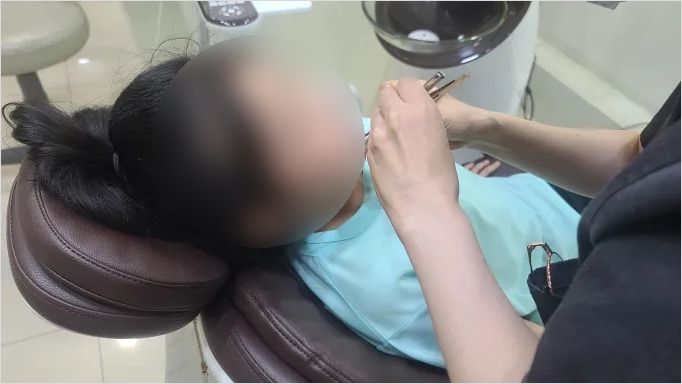 유치 충치치료