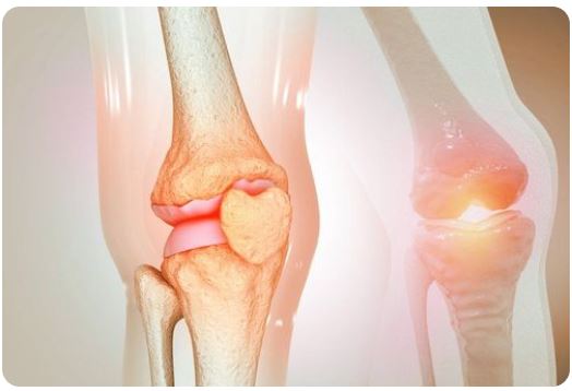 이모튼 캡슐 효능 효과