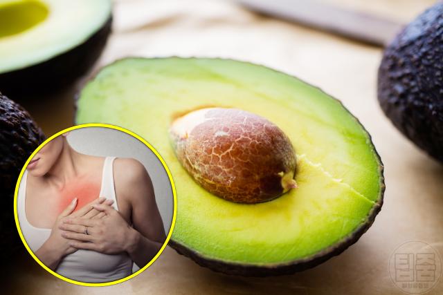 협심증 예방에 좋은 음식 아보카도