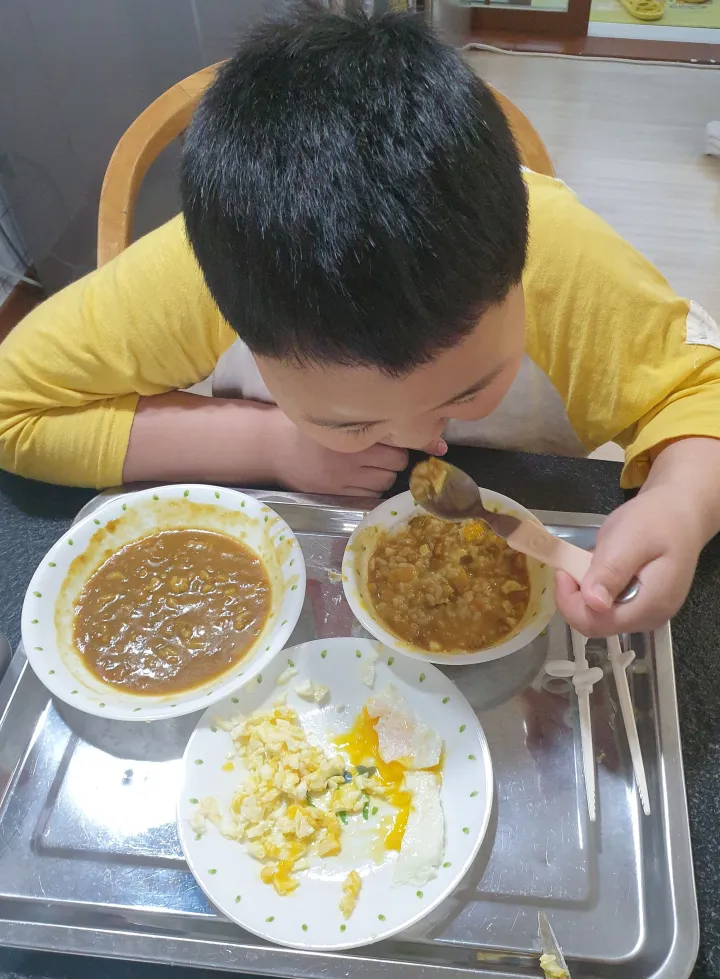 아데노이드-수술-후- 퇴원하고-첫-식사