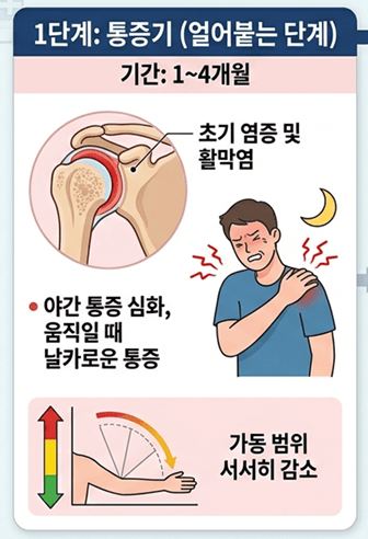 오십견 원인