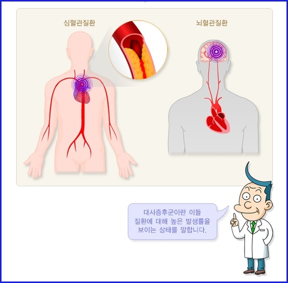 대사증후군 개념도